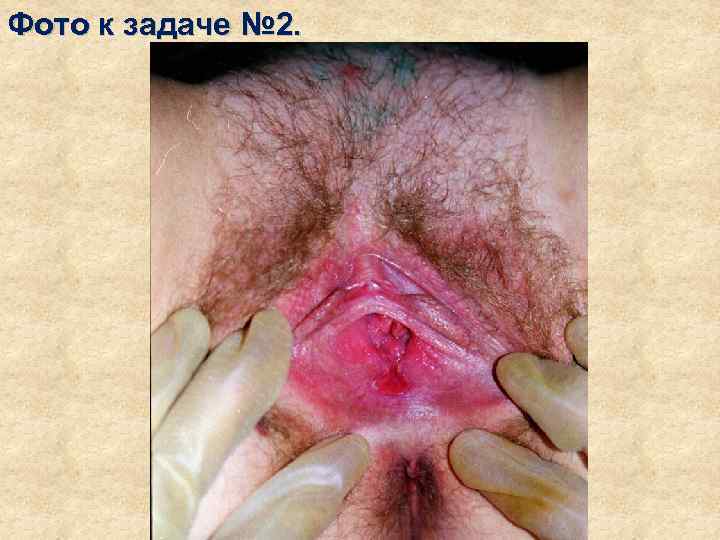 Фото к задаче № 2. 