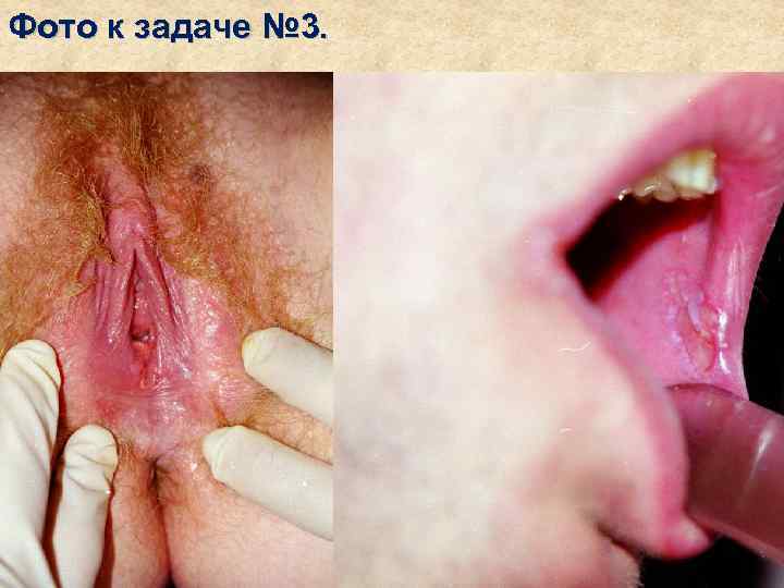 Фото к задаче № 3. 