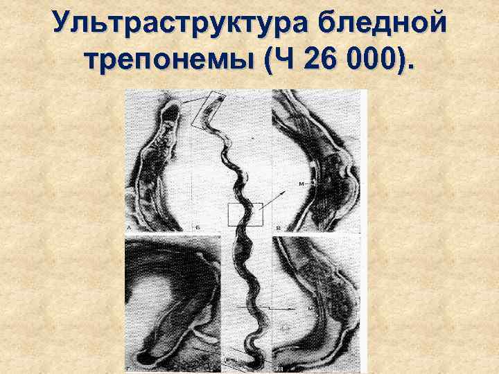 Ультраструктура бледной  трепонемы (Ч 26 000). 