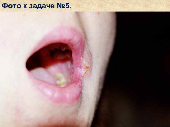 Фото к задаче № 5. 