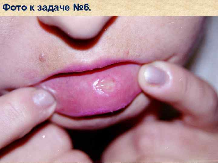 Фото к задаче № 6. 