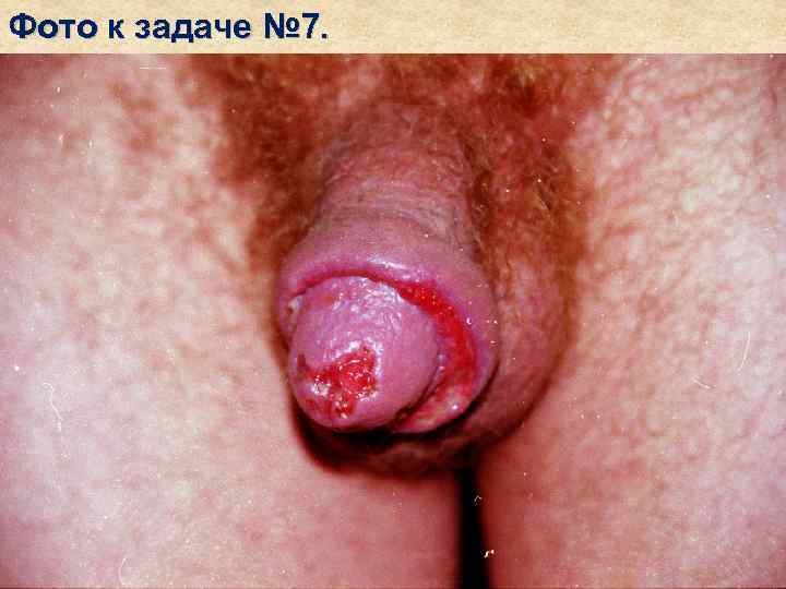 Фото к задаче № 7. 