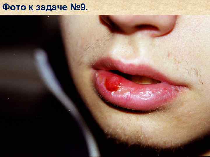 Фото к задаче № 9. 