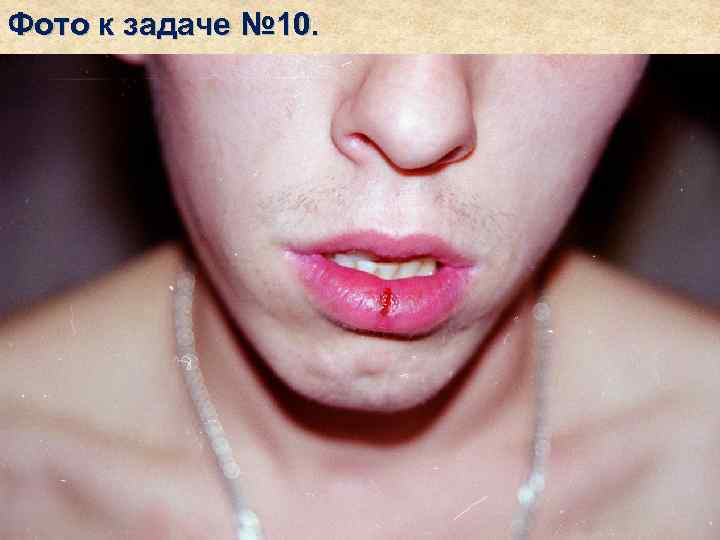 Фото к задаче № 10. 