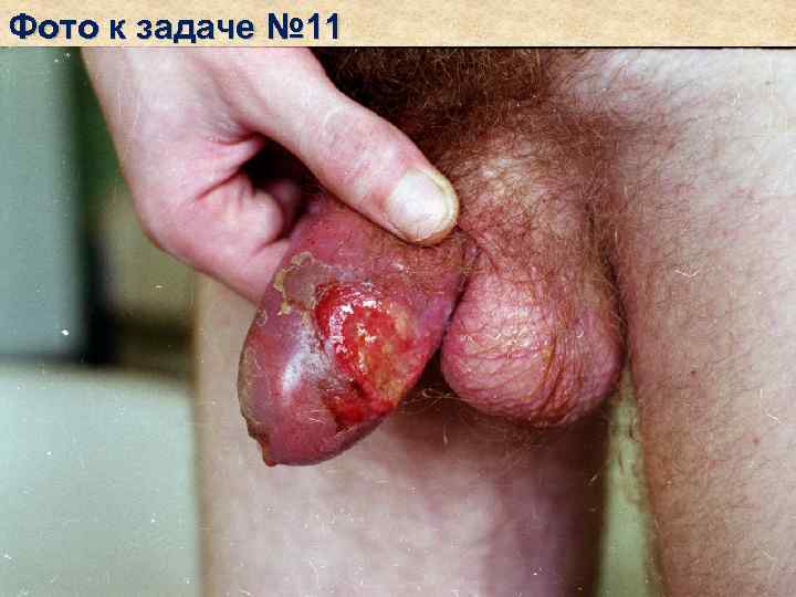 Фото к задаче № 11 