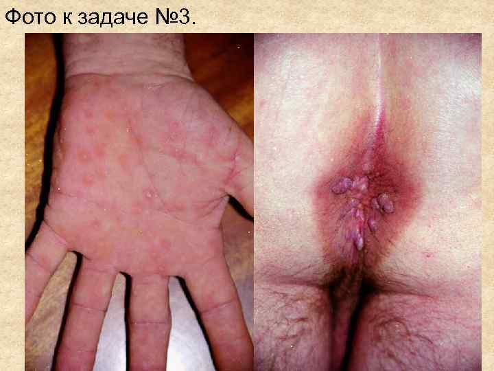 Фото к задаче № 3. Фото к задаче № 3.