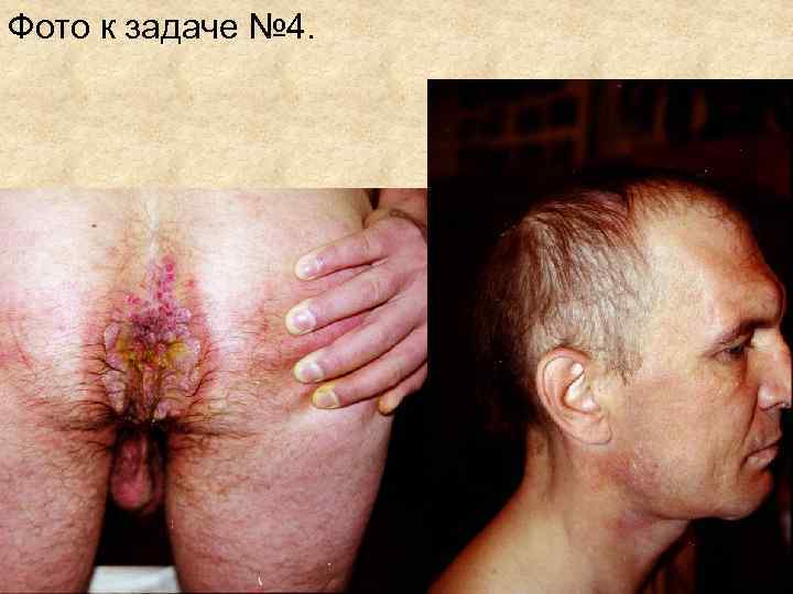 Фото к задаче № 4. Фото к задаче № 4.