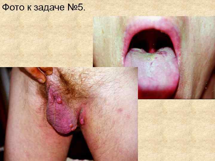 Фото к задаче № 5. Фото к задаче № 5.