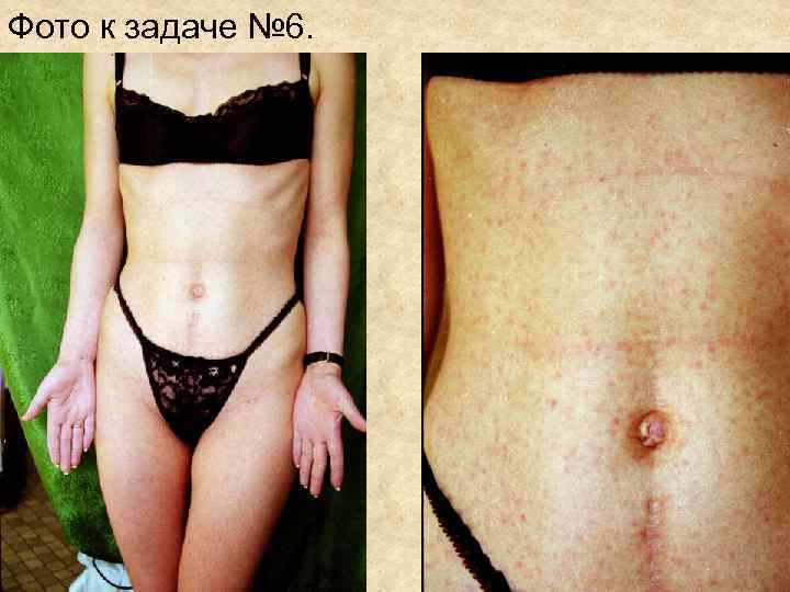 Фото к задаче № 6. Фото к задаче № 6.