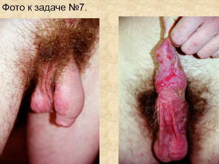 Фото к задаче № 7. Фото к задаче № 7.