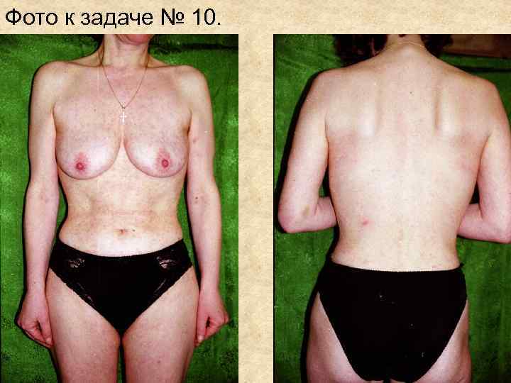 Фото к задаче № 10. Фото к задаче № 10.