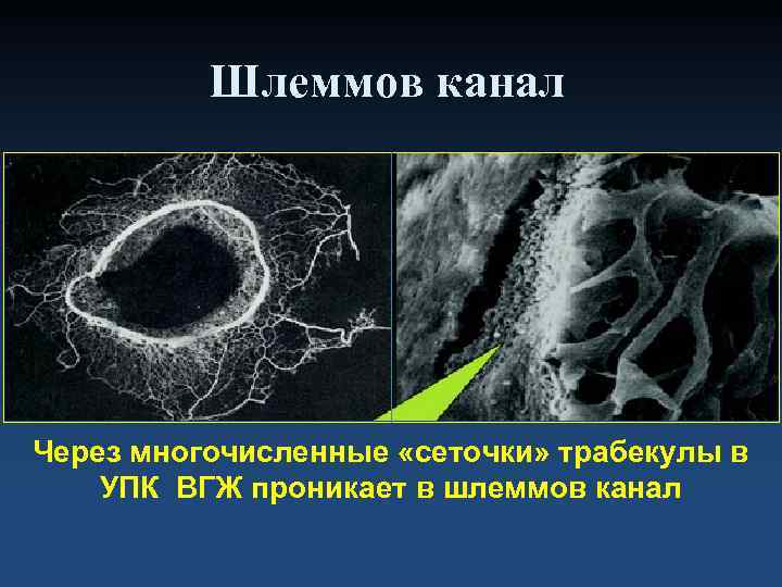    Шлеммов канал Через многочисленные «сеточки» трабекулы в УПК ВГЖ проникает в