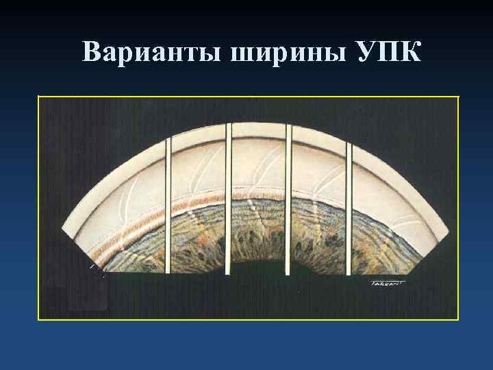 Варианты ширины УПК 