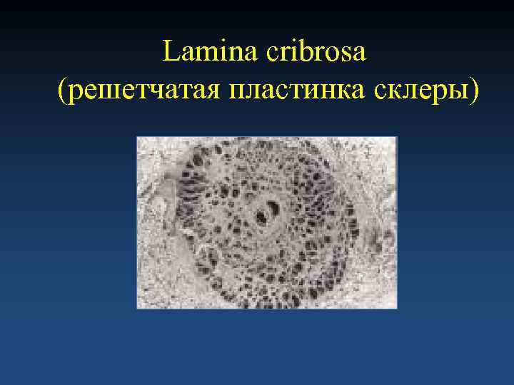   Lamina cribrosa (решетчатая пластинка склеры) 