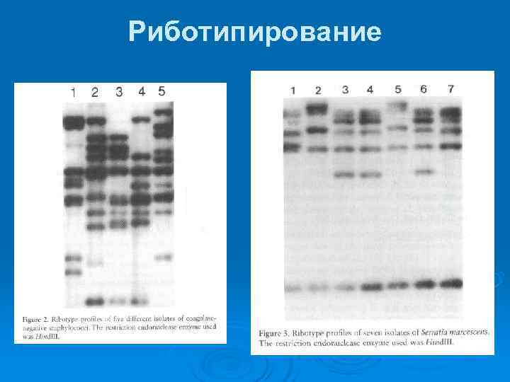 Риботипирование 