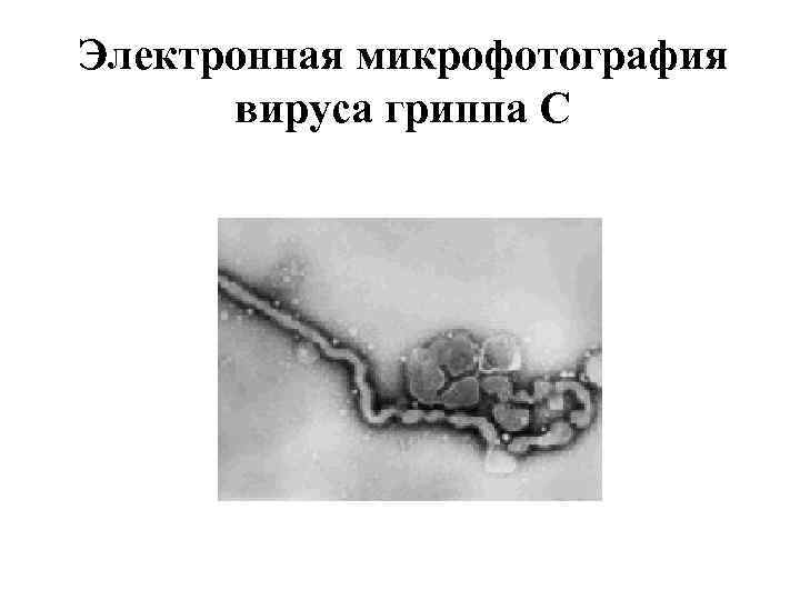 Электронная микрофотография вируса гриппа С Электронная микрофотография вируса гриппа С