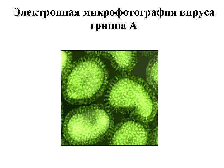 Электронная микрофотография вируса гриппа А Электронная микрофотография вируса гриппа А