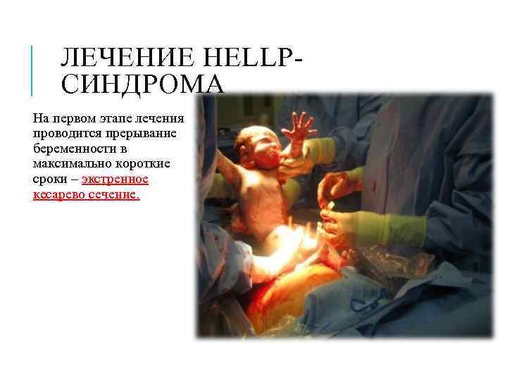   ЛЕЧЕНИЕ HELLP- СИНДРОМА На первом этапе лечения проводится прерывание беременности в максимально