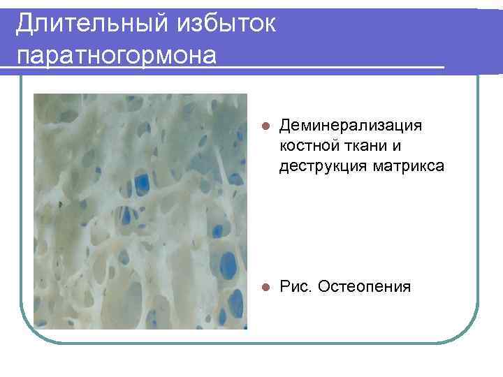 Длительный избыток паратногормона   l  Деминерализация     костной ткани