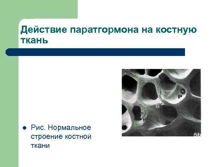 Действие паратгормона на костную ткань l  Рис. Нормальное строение костной ткани 