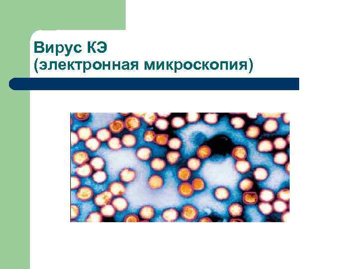 Вирус КЭ (электронная микроскопия) 