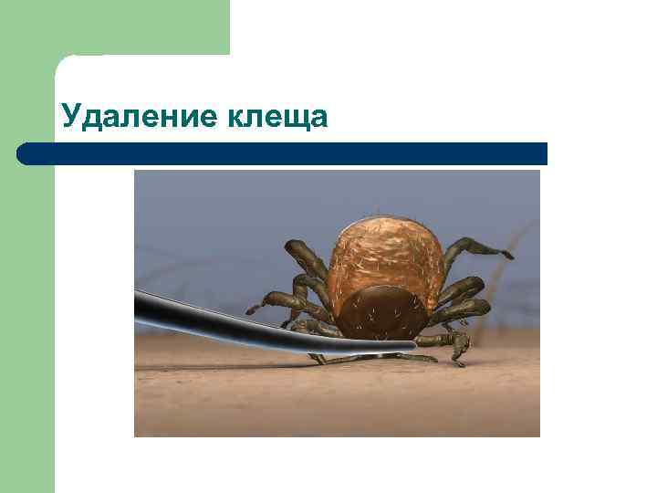 Удаление клеща 
