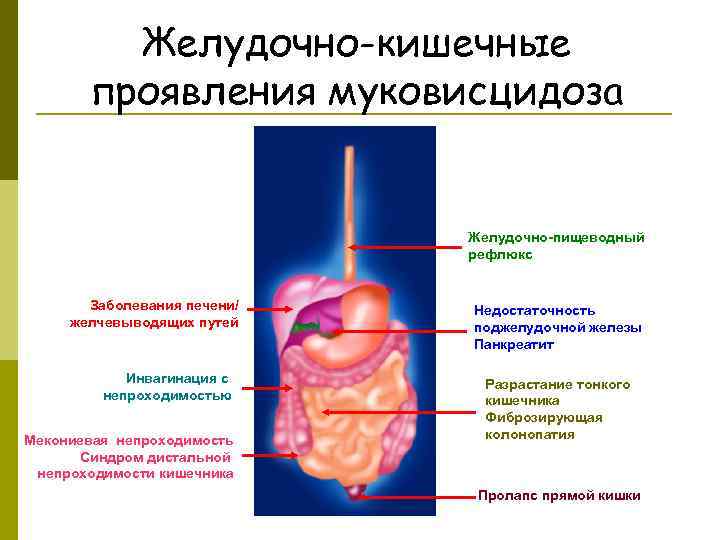    Желудочно-кишечные  проявления муковисцидоза      Желудочно-пищеводный 