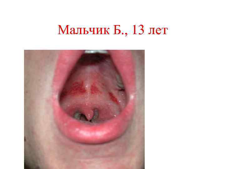 Мальчик Б. , 13 лет 