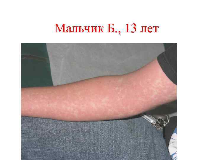 Мальчик Б. , 13 лет 