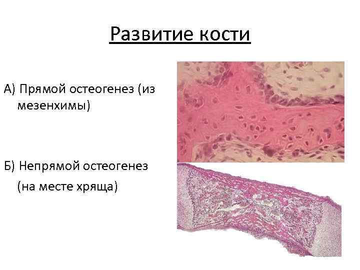 Схема непрямого остеогенеза гистология