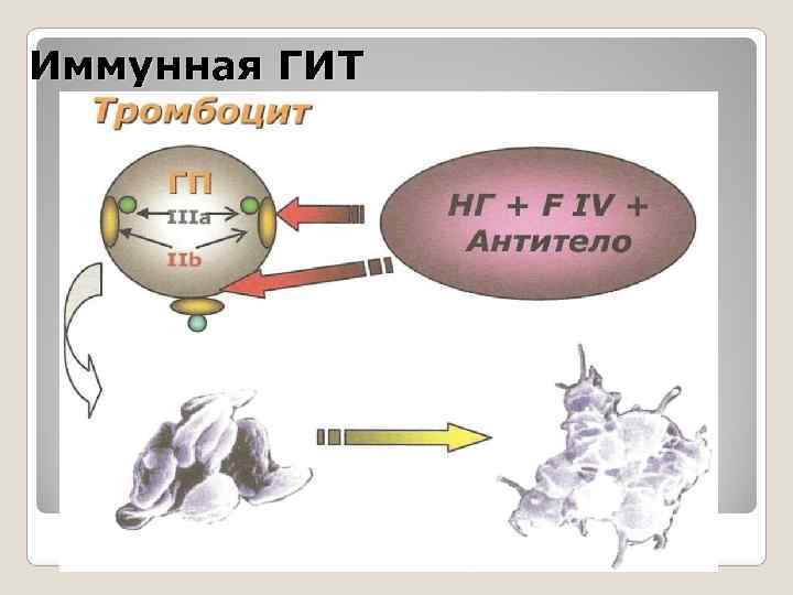 Иммунная ГИТ Иммунная ГИТ