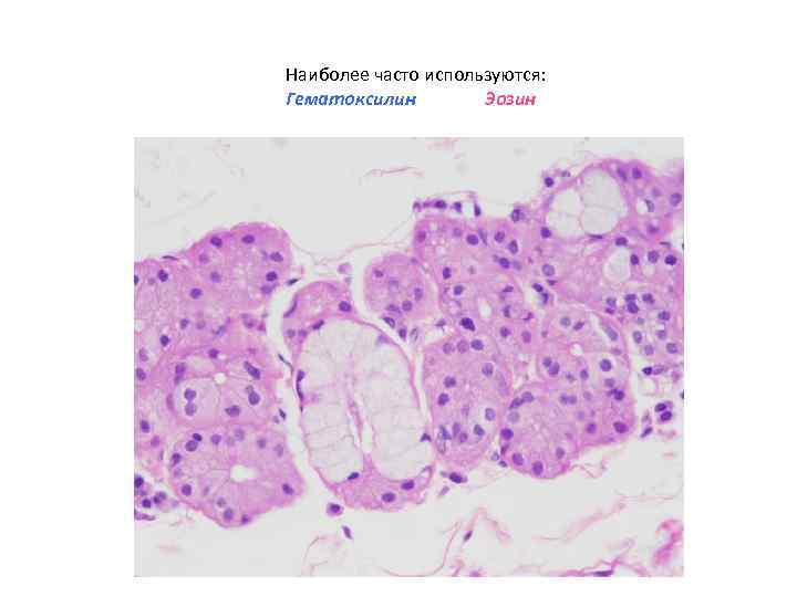 Наиболее часто используются: Гематоксилин   Эозин 