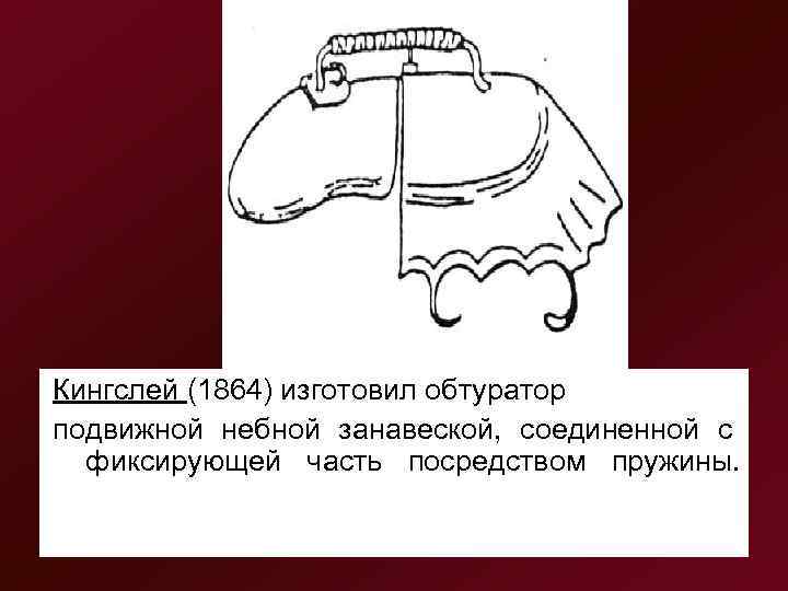 Кингслей (1864) изготовил обтуратор подвижной небной занавеской,  соединенной с  фиксирующей часть посредством