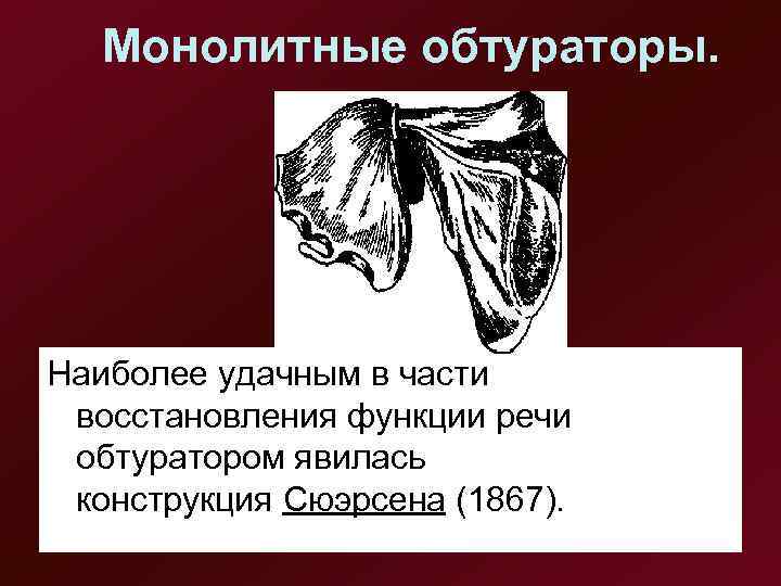  Монолитные обтураторы. Наиболее удачным в части  восстановления функции речи  обтуратором явилась