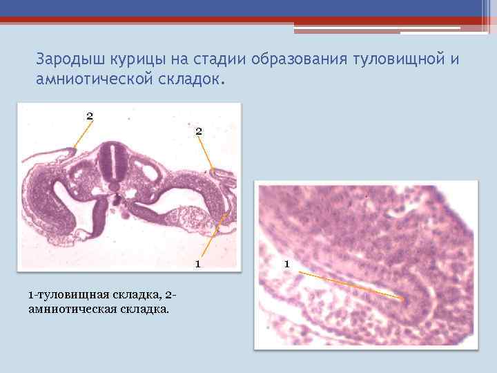 Стадии зародыша курицы. Туловищная и амниотическая складки зародыша курицы. Мезенхима зародыша цыпленка. Зародыш курицы на стадии образования туловищных. Мезенхима зародыша гистология.