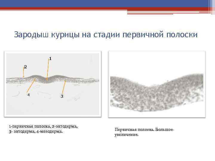 Стадии зародыша курицы. Первичная полоска зародыша курицы препарат. Первичная полоска зародыша курицы гистология. Первичная полоска гистология препарат. Гаструла зародыша курицы первичная полоска.