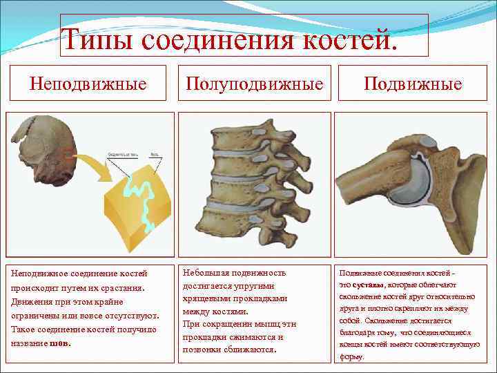   Типы соединения костей. Неподвижные     Полуподвижные   