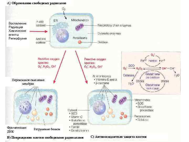 А) Образование свободных радикалов Воспаление Радиация Химические агенты Реперфузия Пероксидное окисление А) Образование свободных радикалов Воспаление Радиация Химические агенты Реперфузия Пероксидное окисление