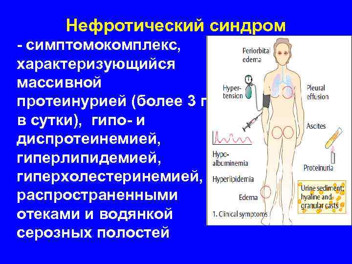 Нефротический криз презентация