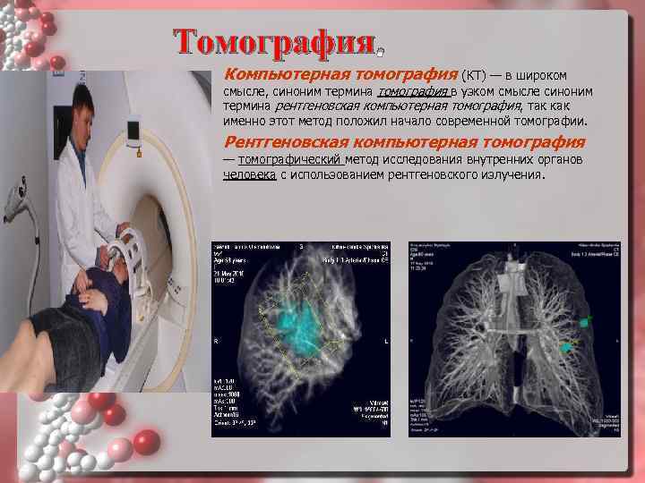 Презентация на тему компьютерная томография в медицине