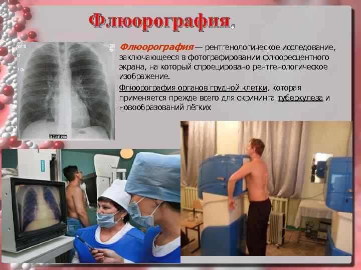 Флюорография.  Флюорография — рентгенологическое исследование, заключающееся в фотографировании флюоресцентного  экрана, на который