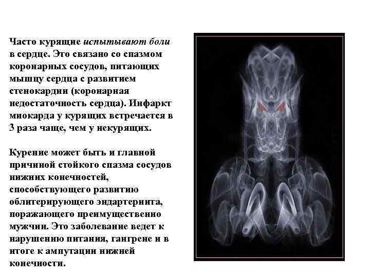 Часто курящие испытывают боли в сердце. Это связано со спазмом коронарных сосудов, питающих мышцу