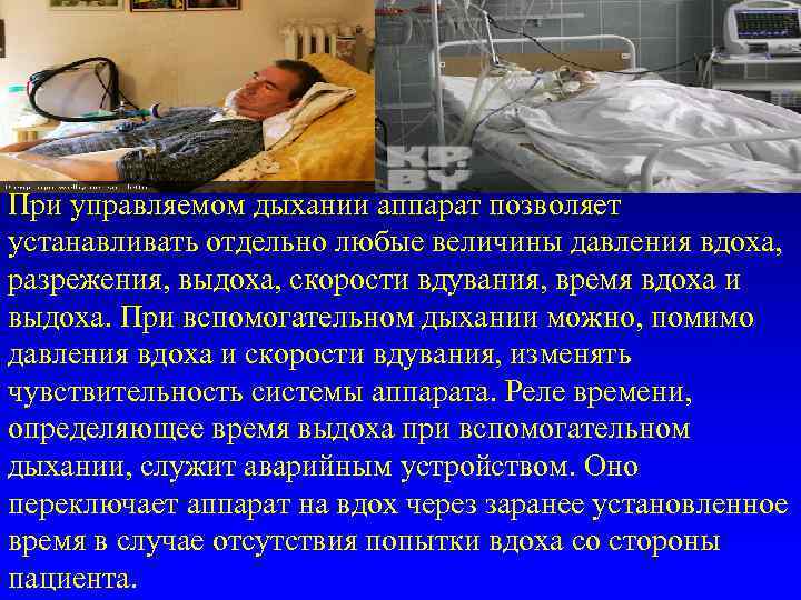      Слайд № 93 При управляемом дыхании аппарат позволяет устанавливать