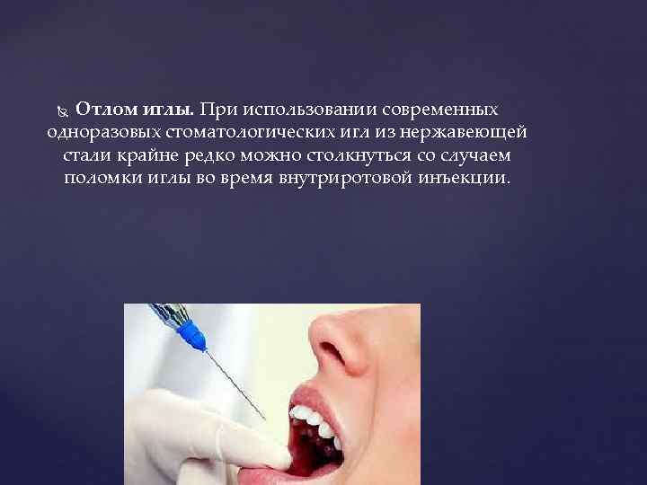   Отлом иглы. При использовании современных одноразовых стоматологических игл из нержавеющей  стали