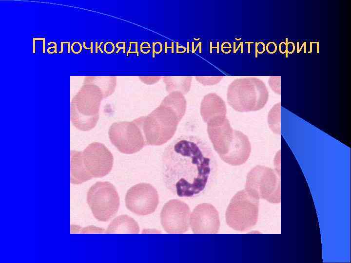 Палочкоядерный нейтрофил Палочкоядерный нейтрофил