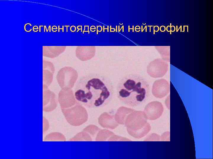 Сегментоядерный нейтрофил Сегментоядерный нейтрофил