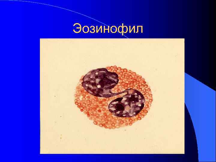 Эозинофил Эозинофил