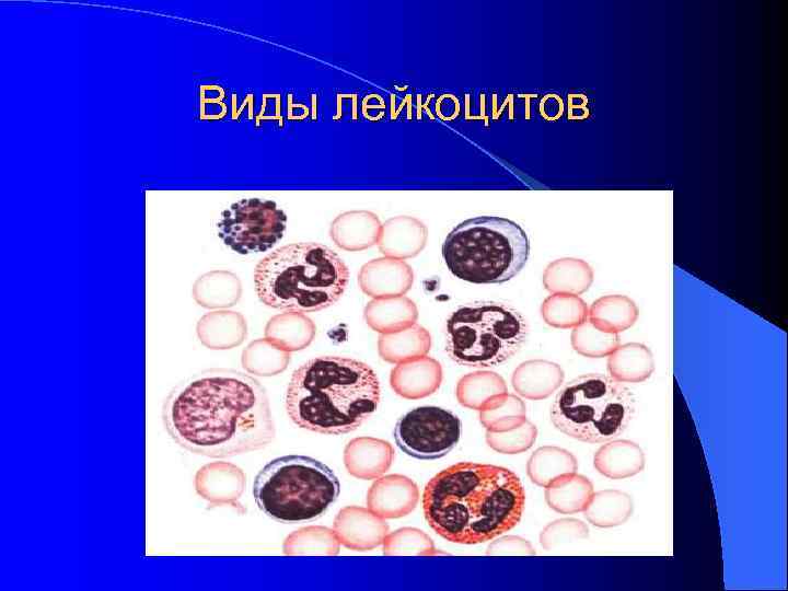 Виды лейкоцитов Виды лейкоцитов