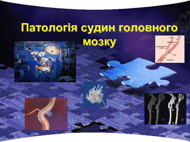 Патологія судин головного мозку 