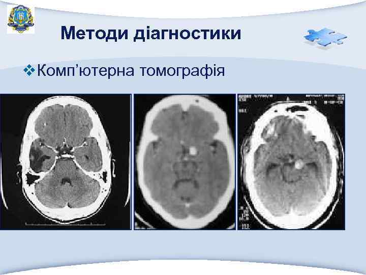 Методи діагностики v. Комп’ютерна томографія 